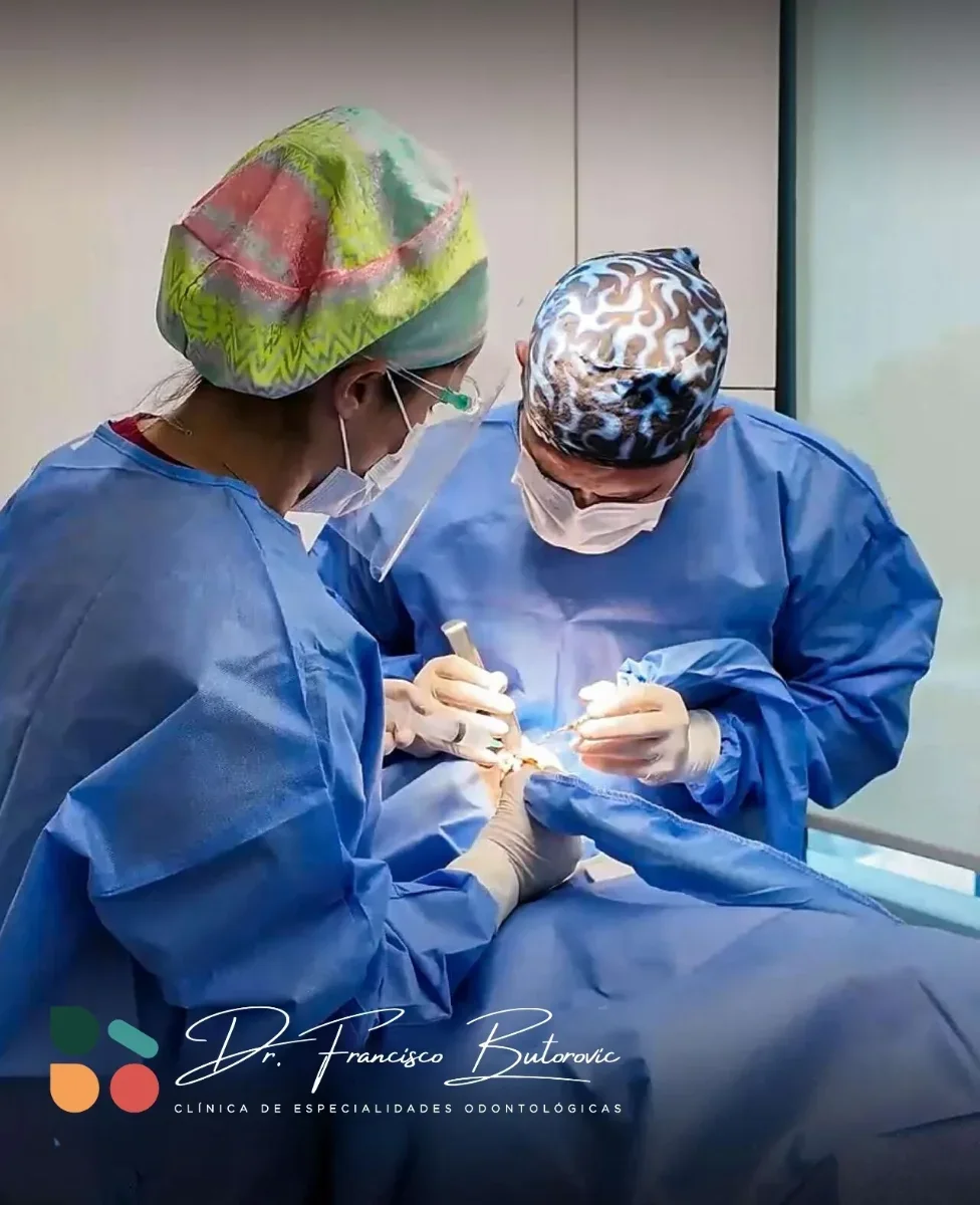 Implantes dentales